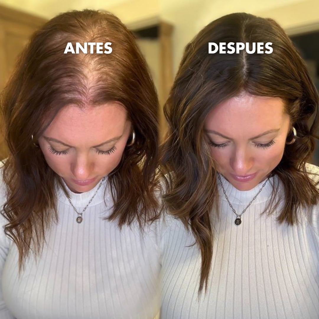 Kit Acelerador de Crecimiento Capilar