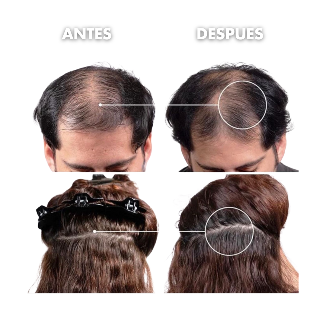 Kit Acelerador de Crecimiento Capilar